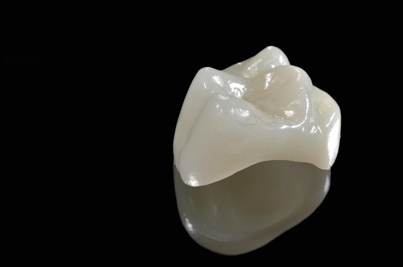 Porcelain Crowns Butler, IN